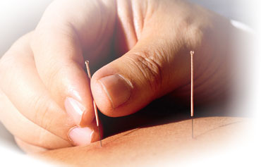 acupuncture2